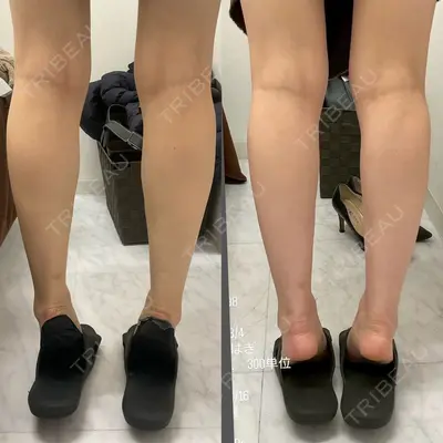 DMTC CLINIC 日本橋院 山中大介医師の症例