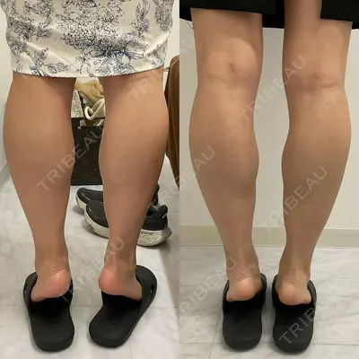 DMTC CLINIC 日本橋院 山中大介医師の症例