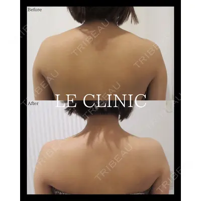 LE CLINICの症例