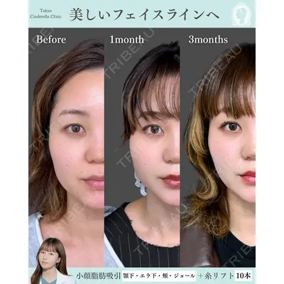 東京シンデレラ美容外科 新宿院 宮﨑友伽医師の症例