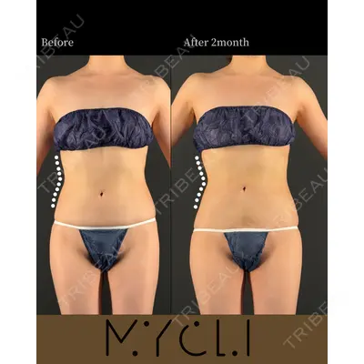 MYCLI【マイクリ】大阪・梅田院 三木 晶森医師の症例