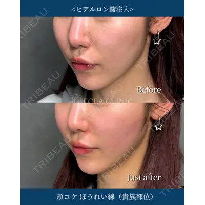 ECLA CLINIC (エクラクリニック)の症例