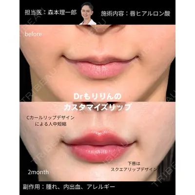 PRISM Beauty Clinic 町田院 森本 理一郎医師の症例