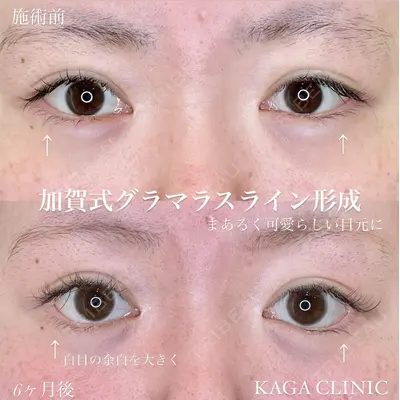 KAGA CLINICの症例