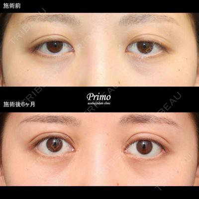 プリモ麻布十番クリニック 大場教弘医師の症例