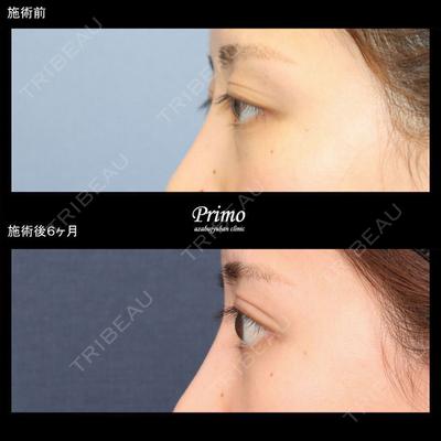 プリモ麻布十番クリニック 大場教弘医師の症例