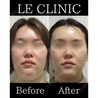 LE CLINIC 喜多　俊博医師の症例