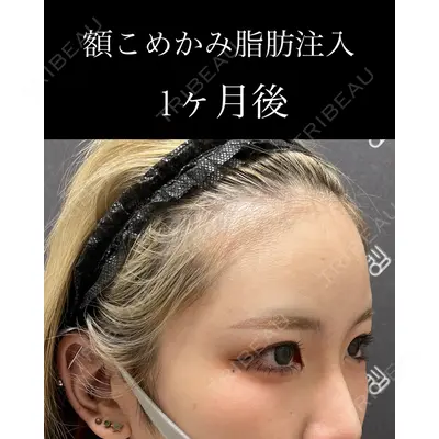 EMMO FACE CLINIC 大宮院 廣松 直樹医師の症例