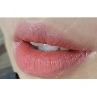 しんゆり美容健康クリニックの症例