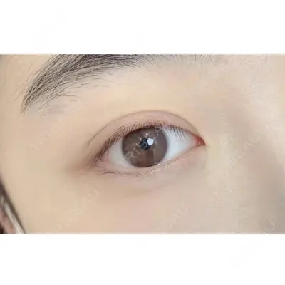 しんゆり美容健康クリニックの症例