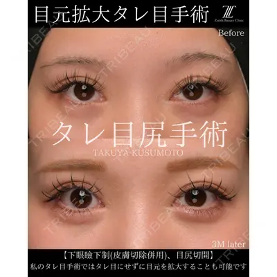 Zetith Beauty Clinic 大阪心斎橋院 楠本 拓哉医師の症例