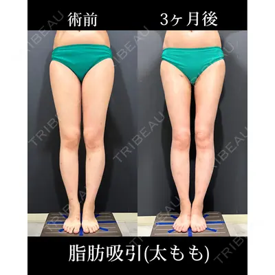 HAAB×DREAM BEAUTY CLINIC 東京本院 吉岡 修一医師の症例