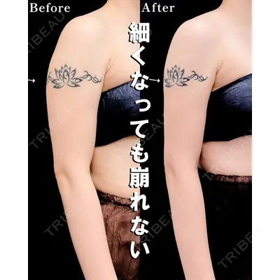 湘南美容クリニック 渋谷院 小草 智之医師の症例