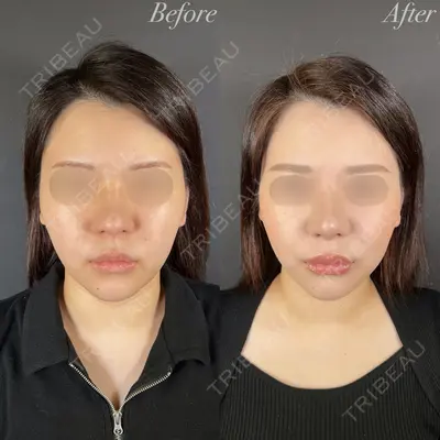 R Beauty CLINIC 大阪院 小池 泰弘医師の症例