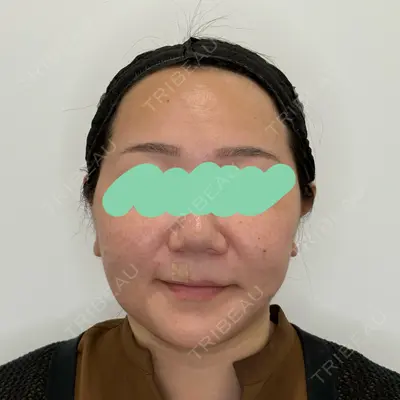 Olivia Clinic 山﨑 香名医師の症例