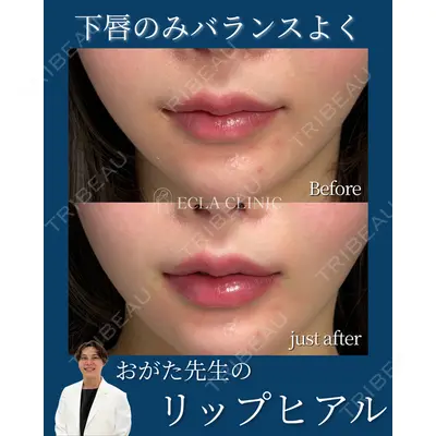 ECLA CLINIC (エクラクリニック) 緒方 善孝医師の症例