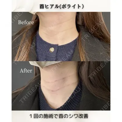 ルラ美容クリニック 静岡院 成田 央良医師の症例