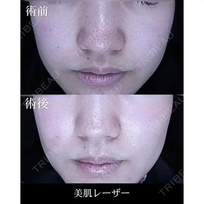 HAAB×DREAM BEAUTY CLINIC 大阪梅田院の症例