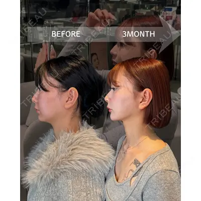 HAAB BEAUTY CLINIC 南青山本院（新院） 金子 雄医師の症例