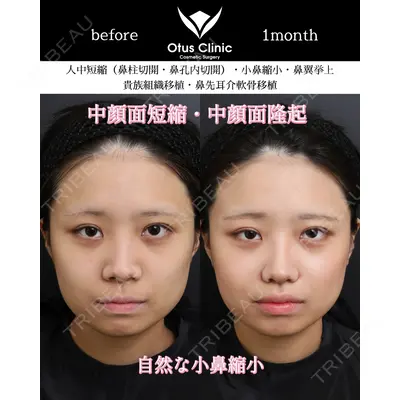 Otus Clinic 【オータスクリニック】 中 徳太郎医師の症例