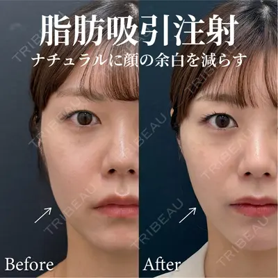 湘南美容クリニック 渋谷院 小草 智之医師の症例