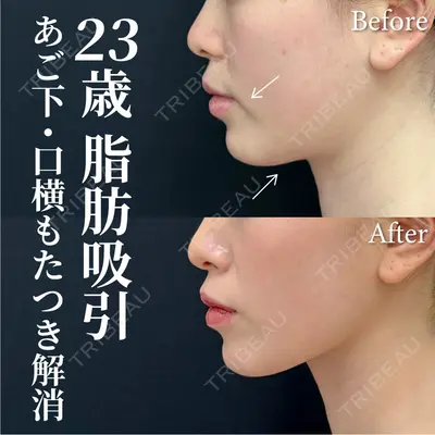 湘南美容クリニック 渋谷院 小草 智之医師の症例