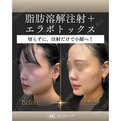 M'sクリニック【エムズクリニック】 谷口 緑医師の症例