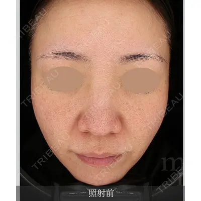 muni skin clinic 高麗 惠理医師の症例
