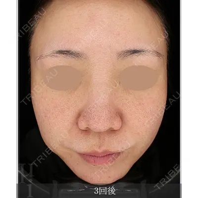 muni skin clinic 高麗 惠理医師の症例
