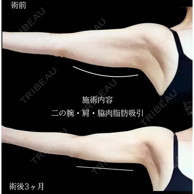 アリエル美容クリニック 横浜院 加藤 敏次医師の症例