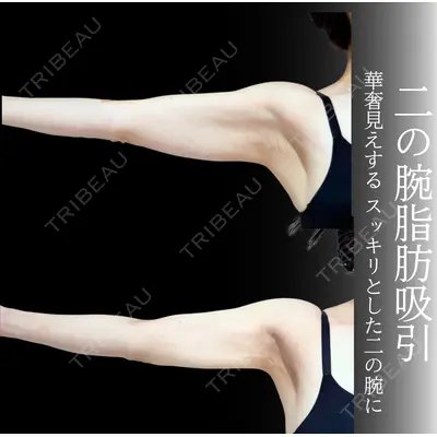 アリエル美容クリニック 横浜院 加藤 敏次医師の症例