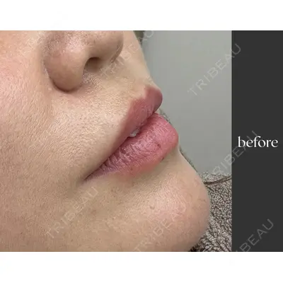 muni skin clinic 高麗 惠理医師の症例