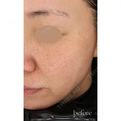 muni skin clinic 高麗 惠理医師の症例