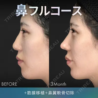ジョウクリニック 銀座院 重本　譲医師の症例