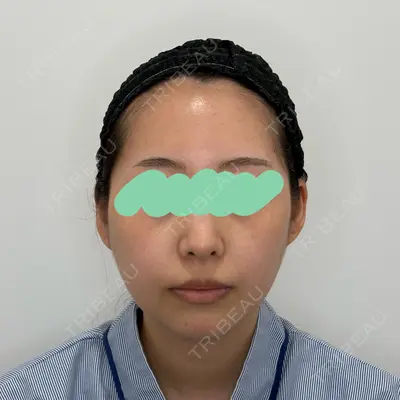 Olivia Clinic 山﨑 香名医師の症例