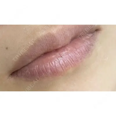 しんゆり美容健康クリニックの症例