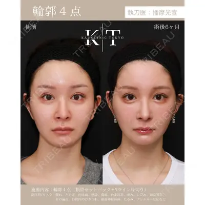KAI CLINIC TOKYO（カイクリニック東京）の症例