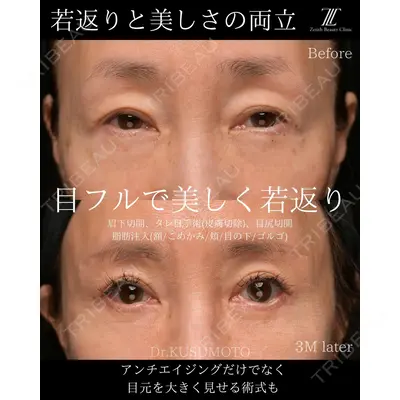 Zetith Beauty Clinic 大阪心斎橋院 楠本 拓哉医師の症例
