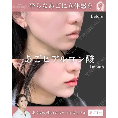 東京シンデレラ美容外科 池袋院 梅田 絢乃医師の症例