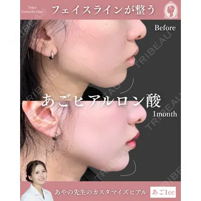 東京シンデレラ美容外科 池袋院 梅田 絢乃医師の症例