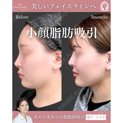 東京シンデレラ美容外科 池袋院 梅田 絢乃医師の症例