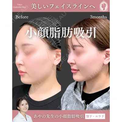 東京シンデレラ美容外科 池袋院 梅田 絢乃医師の症例