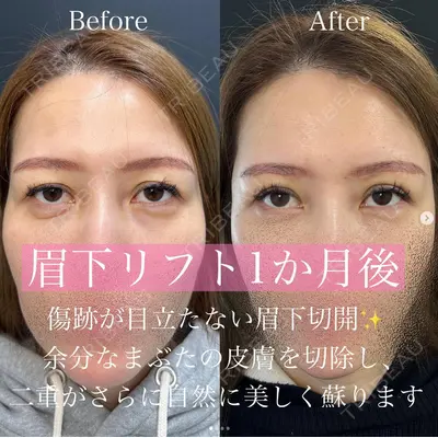 ルラ美容クリニック 渋谷本院 昼間 路子医師の症例
