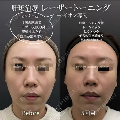 ロレシー美容クリニック 心斎橋駅前院 福留院長医師の症例
