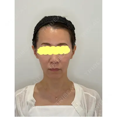 Olivia Clinic 山﨑 香名医師の症例
