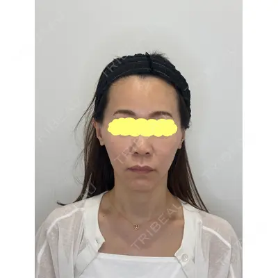 Olivia Clinic 山﨑 香名医師の症例