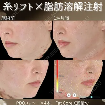 下北沢スキンクリニック 保坂 宗孝医師の症例