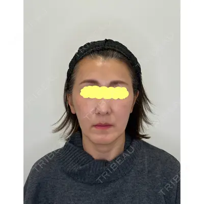 Olivia Clinic 山﨑 香名医師の症例