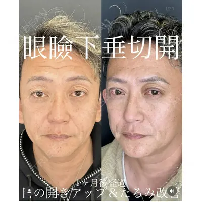 ルラ美容クリニック 渋谷本院 武内 大医師の症例