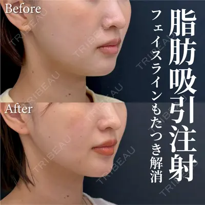 湘南美容クリニック 渋谷院 小草 智之医師の症例